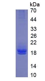 Eukaryotic Interleukin 2 (IL2)