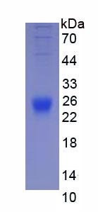 Eukaryotic Interleukin 2 (IL2)