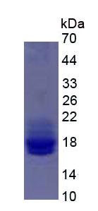 Eukaryotic Interleukin 2 (IL2)