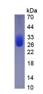 Eukaryotic Interleukin 6 (IL6)