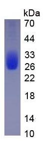 Eukaryotic Interleukin 6 (IL6)