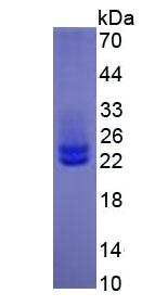 Eukaryotic Interleukin 6 (IL6)