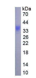 Eukaryotic Interleukin 6 (IL6)