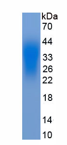 Eukaryotic Monocyte Chemotactic Protein 1 (MCP1)