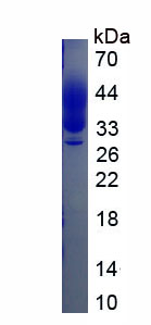 Eukaryotic Colony Stimulating Factor 1, Macrophage (MCSF)