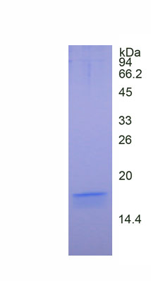 Eukaryotic Macrophage Inflammatory Protein 1 Beta (MIP1b)