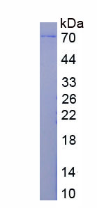 Eukaryotic Matrix Metalloproteinase 2 (MMP2)