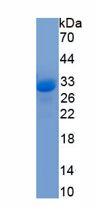 Eukaryotic Superoxide Dismutase 3, Extracellular (SOD3)