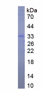 Eukaryotic Superoxide Dismutase 3, Extracellular (SOD3)