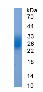 Eukaryotic Stem Cell Factor (SCF)