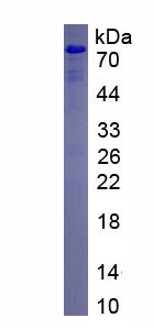 Eukaryotic Stem Cell Factor Receptor (SCFR)