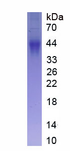 Eukaryotic Transforming Growth Factor Beta 1 (TGFb1)