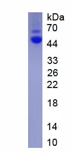 Eukaryotic Transforming Growth Factor Beta 1 (TGFb1)