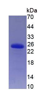 Eukaryotic Tissue Inhibitors Of Metalloproteinase 2 (TIMP2)