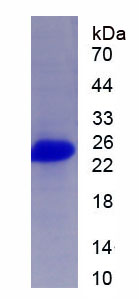 Eukaryotic Tissue Inhibitors Of Metalloproteinase 2 (TIMP2)