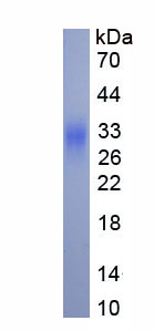 Eukaryotic Interferon Beta (IFNb)