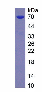 Eukaryotic Anti-Mullerian Hormone (AMH)