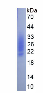 Eukaryotic Connexin 43 (CX43)