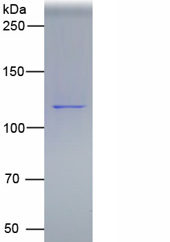 Eukaryotic Platelet/Endothelial Cell Adhesion Molecule (PECAM1)