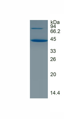 Eukaryotic Gelsolin (GSN)