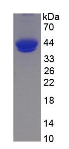 Eukaryotic Complement Component 5a (C5a)