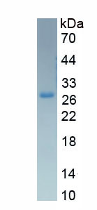 Eukaryotic Sex Hormone Binding Globulin (SHBG)