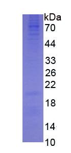 Eukaryotic Sex Hormone Binding Globulin (SHBG)