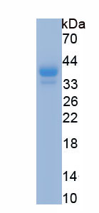 Eukaryotic High Mobility Group Protein 1 (HMGB1)