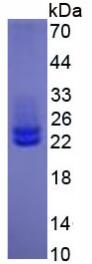 Eukaryotic Proteolipid Protein 1, Myelin (PLP1)
