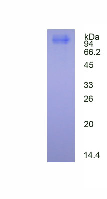 Eukaryotic Thrombomodulin (TM)