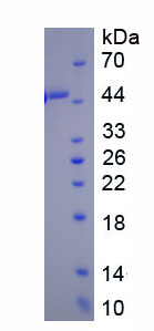 Eukaryotic Plasminogen Activator Inhibitor 1 (PAI1)