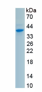 Eukaryotic Myelin Basic Protein (MBP)