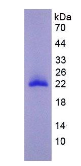 Eukaryotic Matrix Metalloproteinase 9 (MMP9)