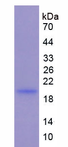 Eukaryotic Interleukin 1 Beta (IL1b)