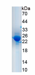 Eukaryotic Interleukin 1 Beta (IL1b)