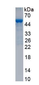 Eukaryotic Procollagen III N-Terminal Propeptide (PIIINP)