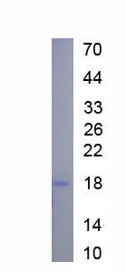 Eukaryotic Calmodulin (CAM)