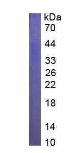 Eukaryotic Cluster Of Differentiation 28 (CD28)