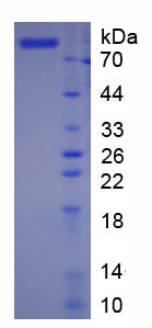 Eukaryotic Coagulation Factor XII (F12)