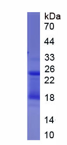 Eukaryotic Cluster Of Differentiation 38 (CD38)