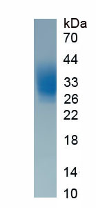 Eukaryotic Chemokine C-X-C-Motif Ligand 16 (CXCL16)