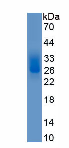 Eukaryotic Von Willebrand Factor (vWF)