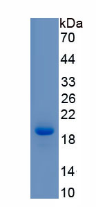 Eukaryotic Corticotropin Releasing Factor (CRF)
