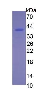 Eukaryotic Resistin (RETN)