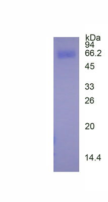 Eukaryotic Phospholipase A2 Group VII (LpPLA2)