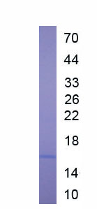 Eukaryotic Cystatin C (Cys-C)