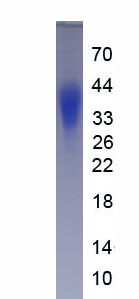 Eukaryotic Tubulin Polymerization Promoting Protein (TPPP)