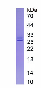 Eukaryotic Integrin Alpha X (CD11c)