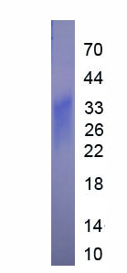 Eukaryotic Interleukin 31 (IL31)