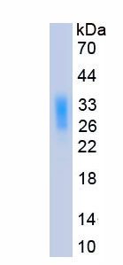 Eukaryotic Interleukin 31 (IL31)